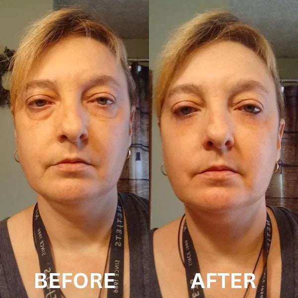 Vital™ - Patch Occhi