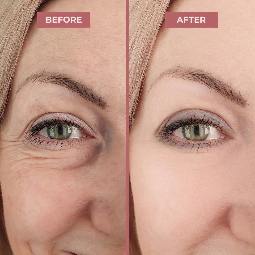 Vital™ - Patch Occhi